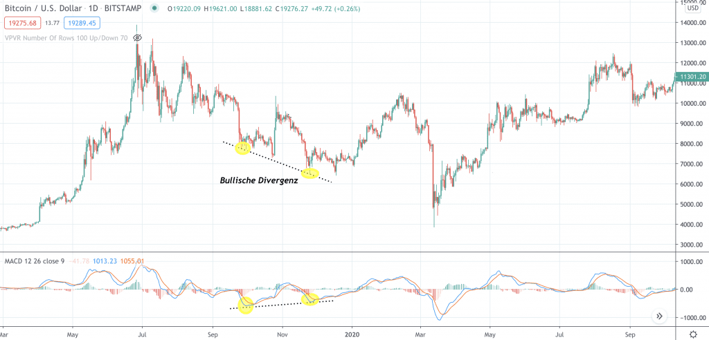 Was ist die Moving Average Convergence Divergence (MACD)