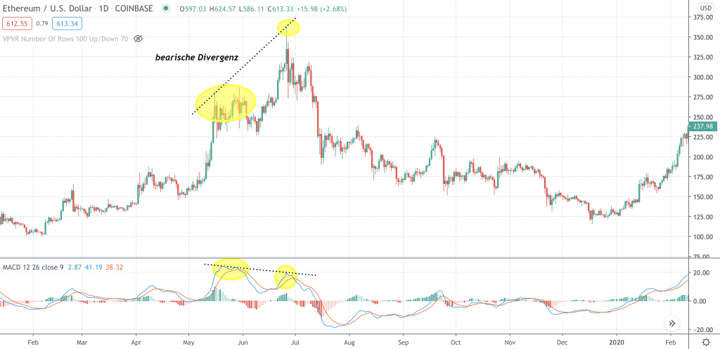 Was ist die Moving Average Convergence Divergence (MACD)